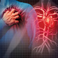 Predicting Heart Attacks - News for Kids
