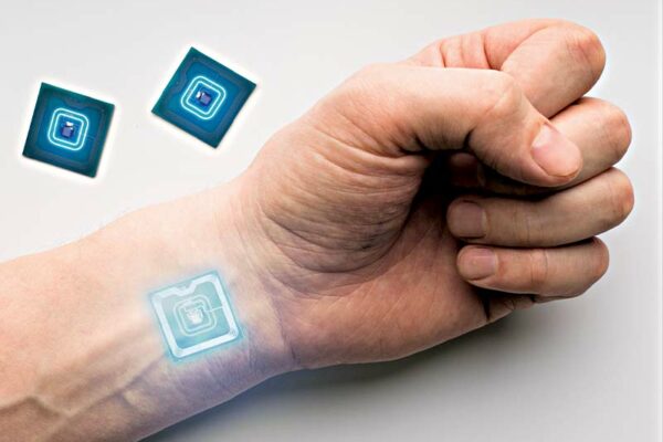 Wireless Electronic Skin