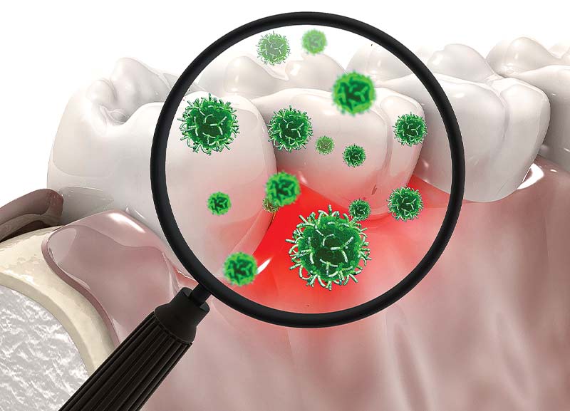 Microrobots That Floss and Brush Teeth