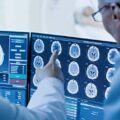 New Images of the Human Brain - News for Kids
