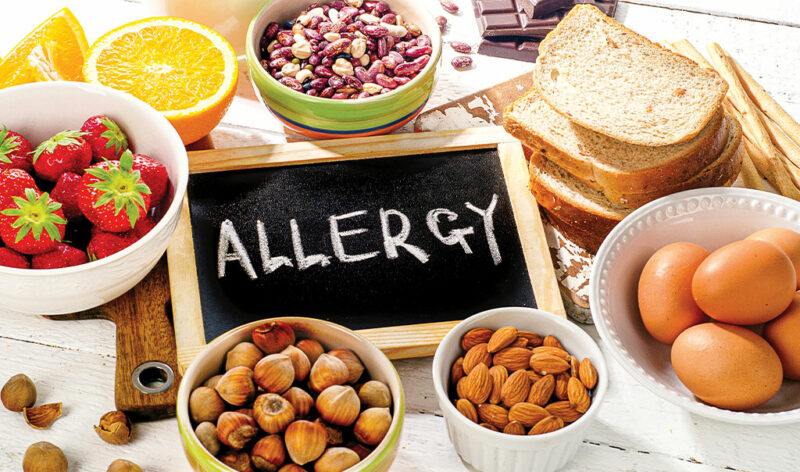 What Is a Food Allergy? 