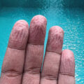 Study on Finger Wrinkles 