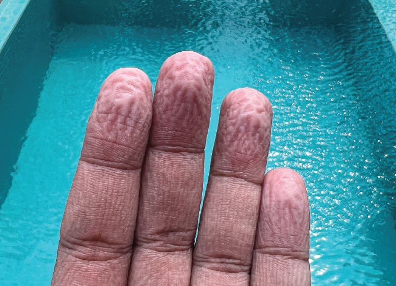 Study on Finger Wrinkles
