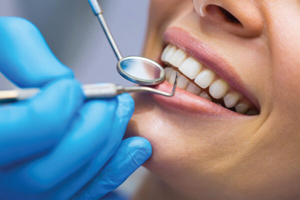 Repairing Teeth Using Wool  