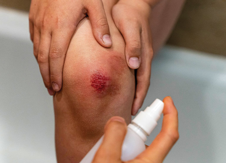 Healing Wounds Quickly